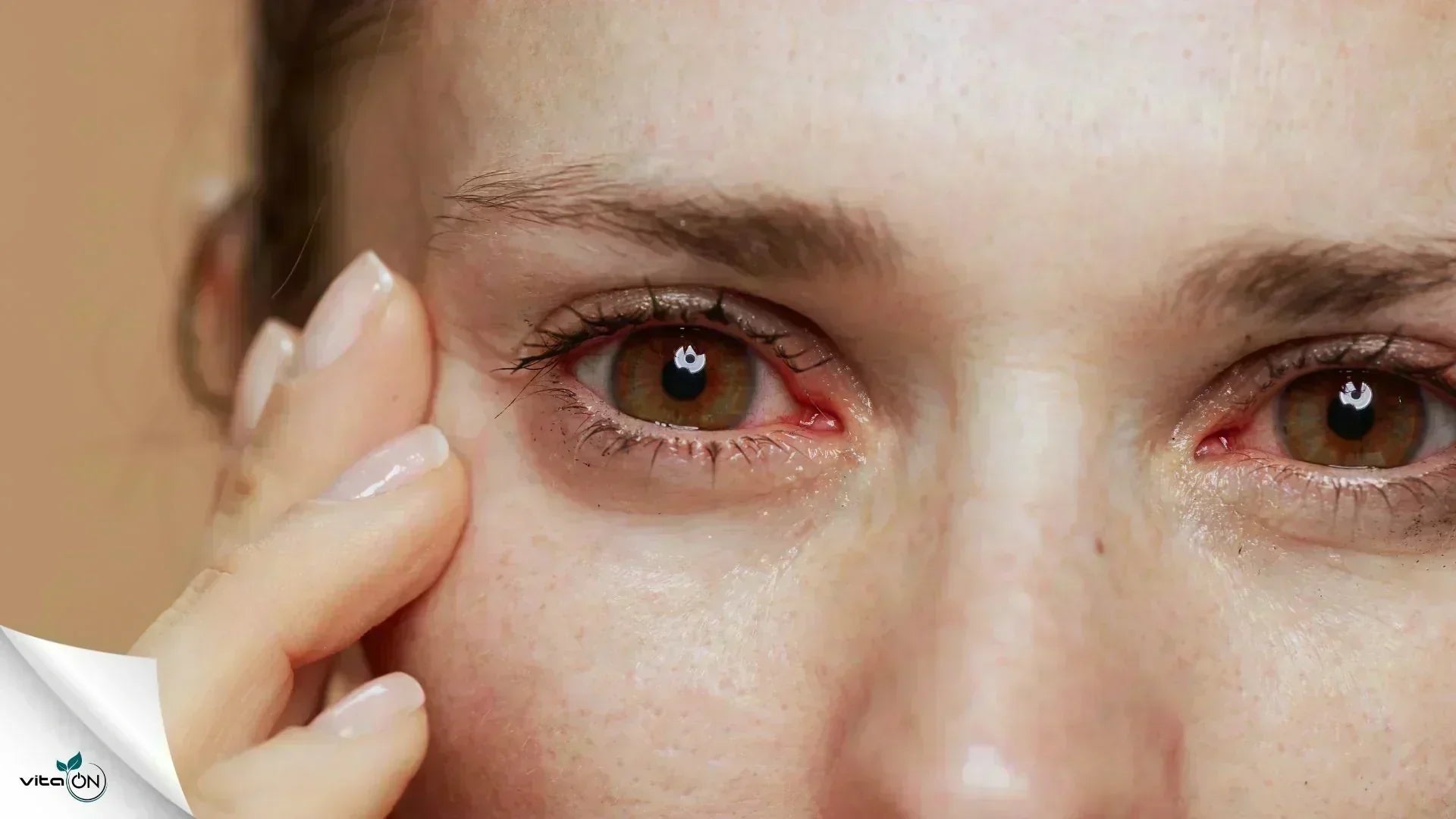 8 Hausmittel gegen trockene Augen